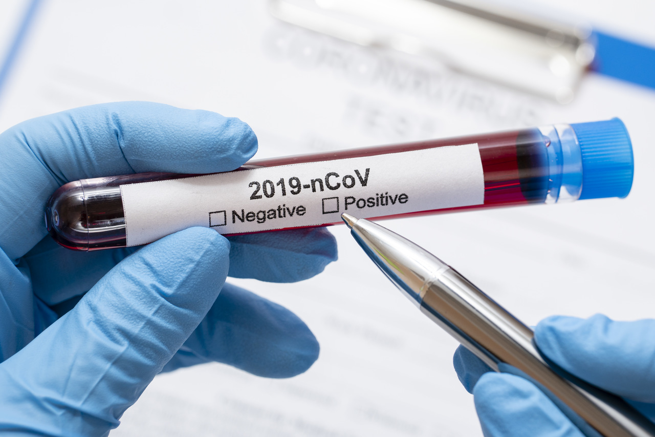 Novas alternativas de teste para coronavírus