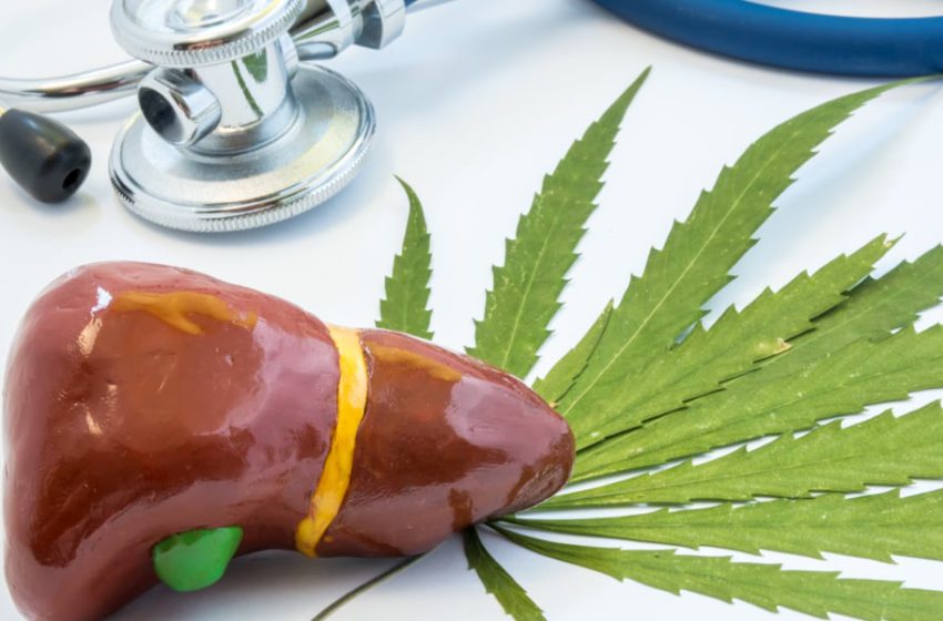 O uso de cannabis poderia influenciar em transplante de fígado?