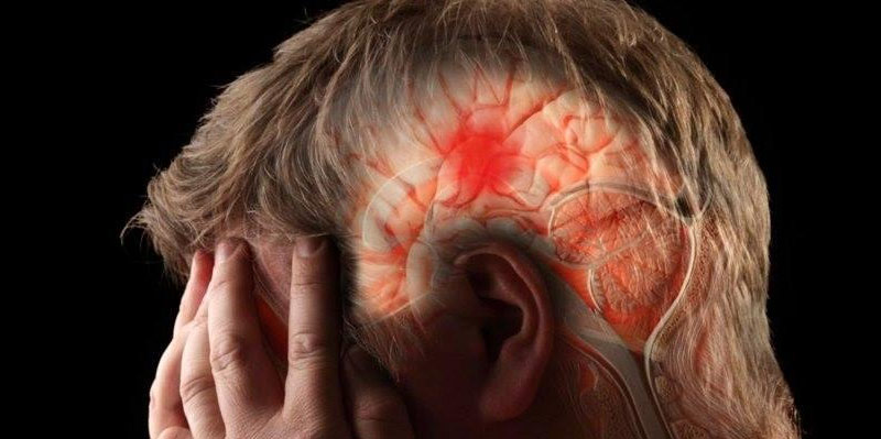  Acidente Vascular Cerebral (AVC): O que é, Causas, Sintomas e Tratamentos