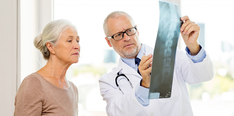  Osteoporose: O que é, Causas, Sintomas e Tratamentos
