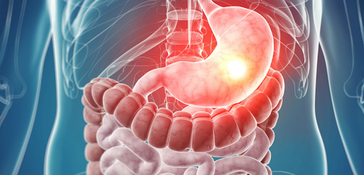  Hemorragia digestiva: O que é, Causas, Sintomas e Tratamentos