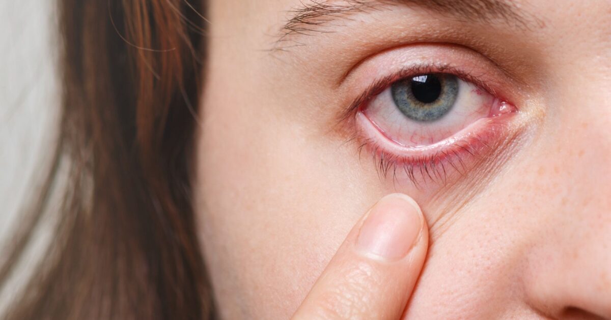 Cannabis para glaucoma: o que se sabe?