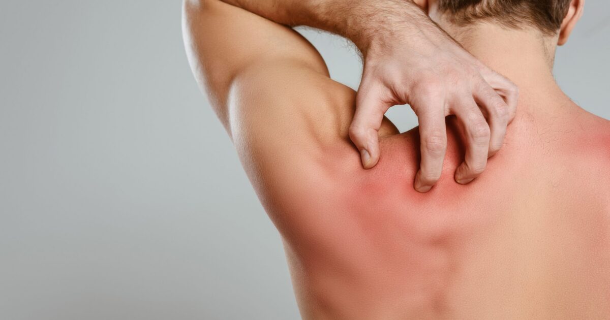 CBD pode ser usado como relaxante muscular?