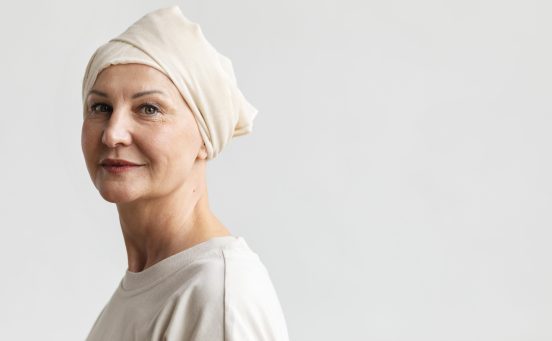 retrato-de-mulher-de-meia-idade-com-cancer-de-pele-1-scaled-1.jpg